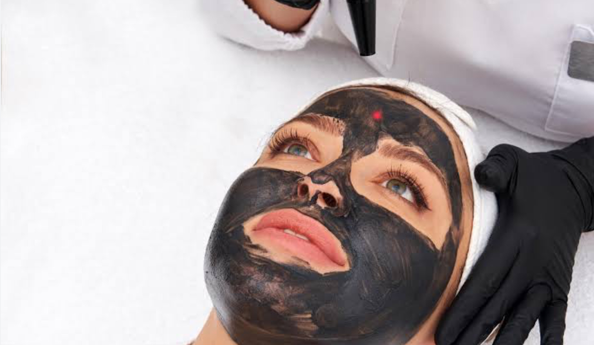 ليزر كاربوني للوجه