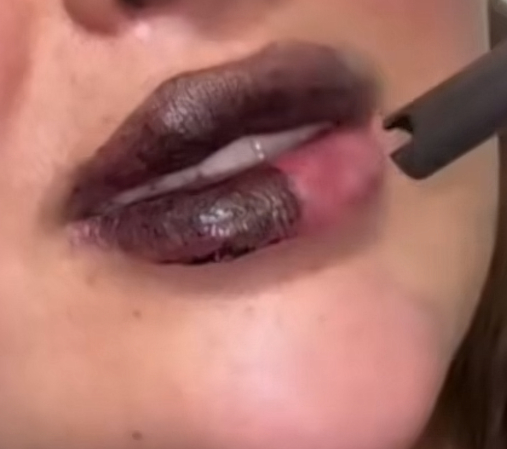 تقشير ليزر كاربوني لتوريد الشفايف